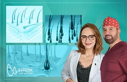 Stem Cell Organic Hair Transplant