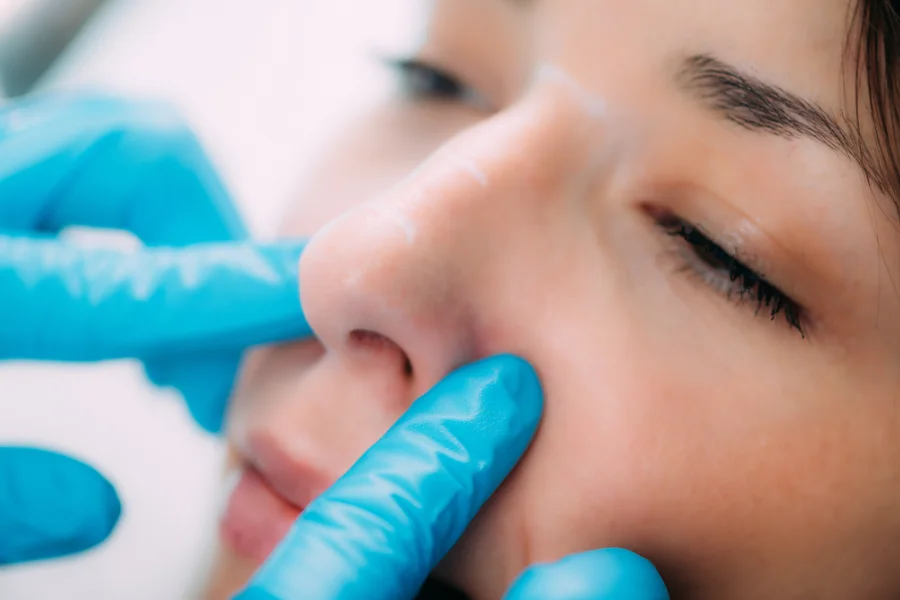 Burun ameliyatı sonrası atel ve silikon tampon süreci