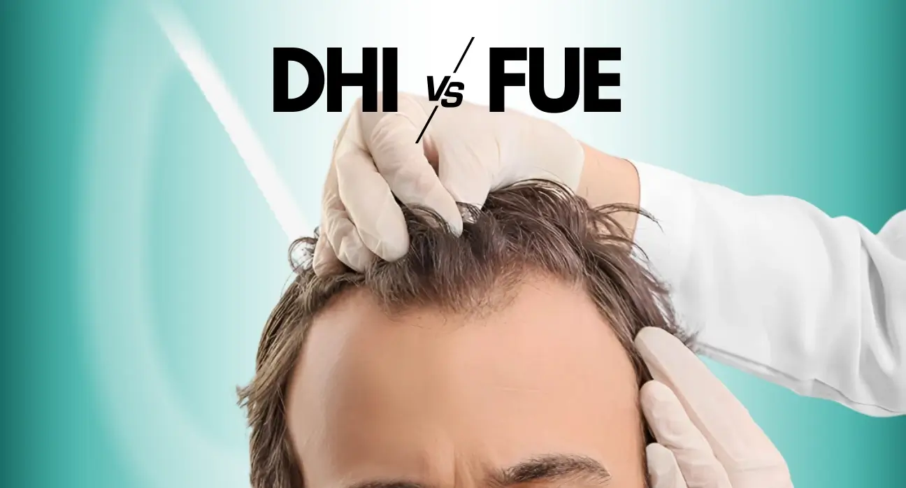 Illustration comparing DHI and FUE hair transplant techniques, showing graft placement precision at Estetik International.