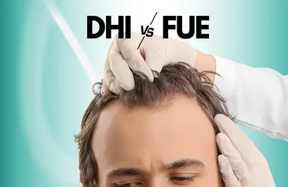 Illustration comparing DHI and FUE hair transplant techniques, showing graft placement precision at Estetik International.