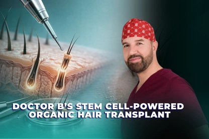 Stem Cell Organic Hair Transplant