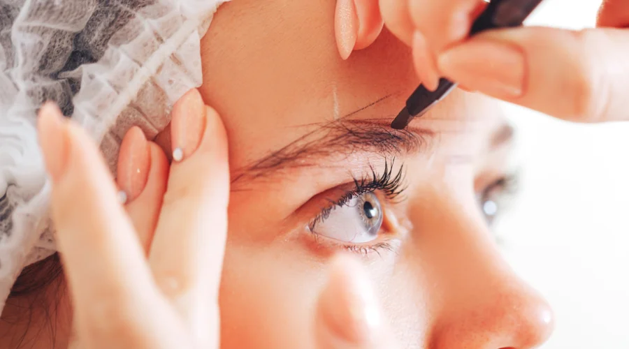 Advanced facial mapping for a natural eyebrow transplant at Estetik International Istanbul