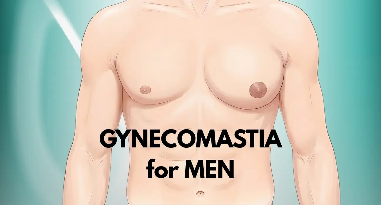 Illustration showing gynecomastia causes and treatment approach, highlighting male chest reduction at Estetik International.