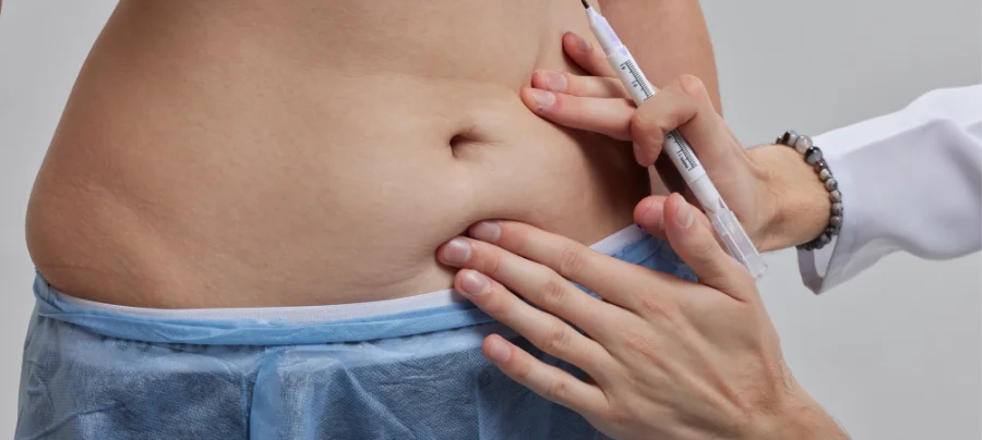 Soğuk lipoliz ve bölgesel incelme öncesi uzman doktor tarafından yapılan muayene ve planlama