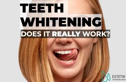 A confident woman with a radiant, white smile, symbolizing the final touch of her aesthetic transformation at Estetik International.