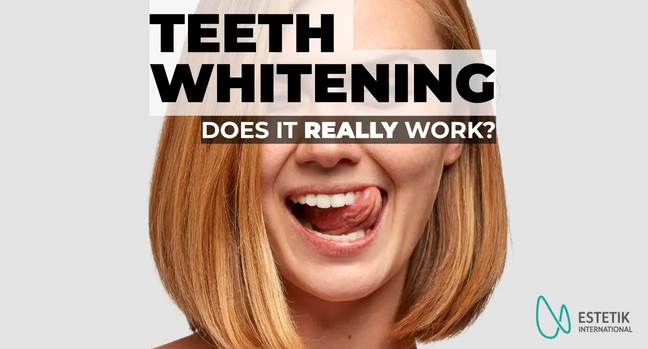 A confident woman with a radiant, white smile, symbolizing the final touch of her aesthetic transformation at Estetik International.