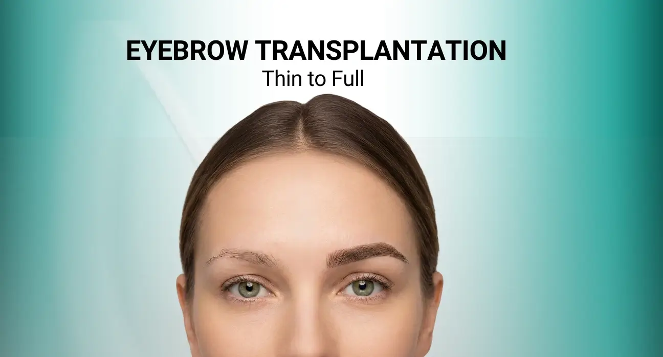 Woman with naturally full and shaped eyebrows after hair transplantation procedure at Estetik International.