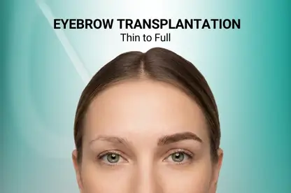 Woman with naturally full and shaped eyebrows after hair transplantation procedure at Estetik International.