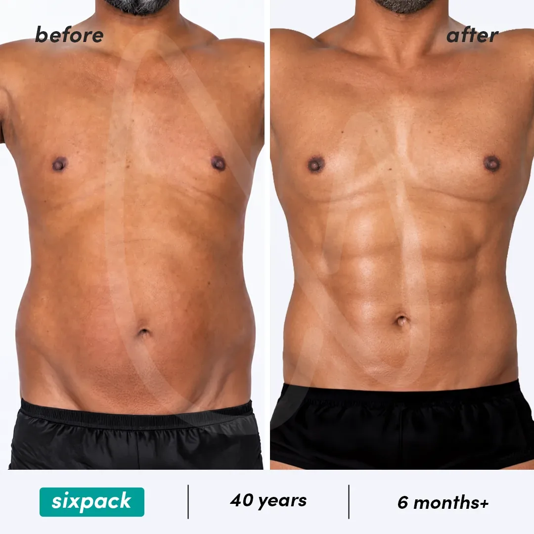Chirurgie du Six-pack before and after