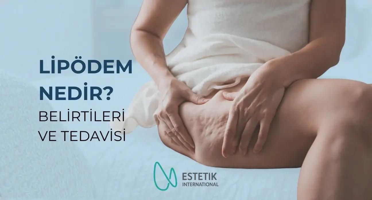 Lipödem Nedir? Belirtileri, Evreleri ve Tedavi Yöntemleri