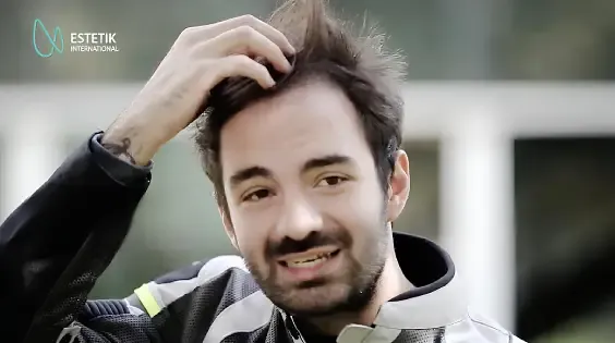 Your Hair’s Comeback, the Organic Way!