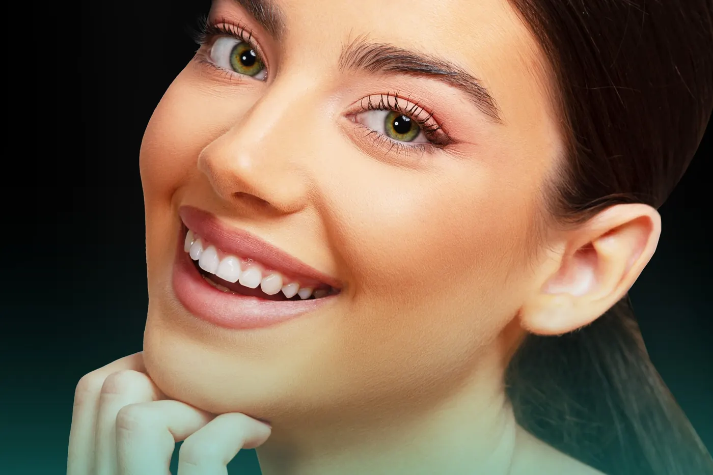 Smile Makeover