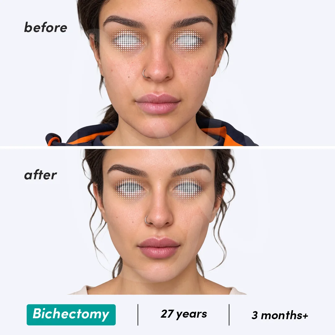 Before-After Combined
