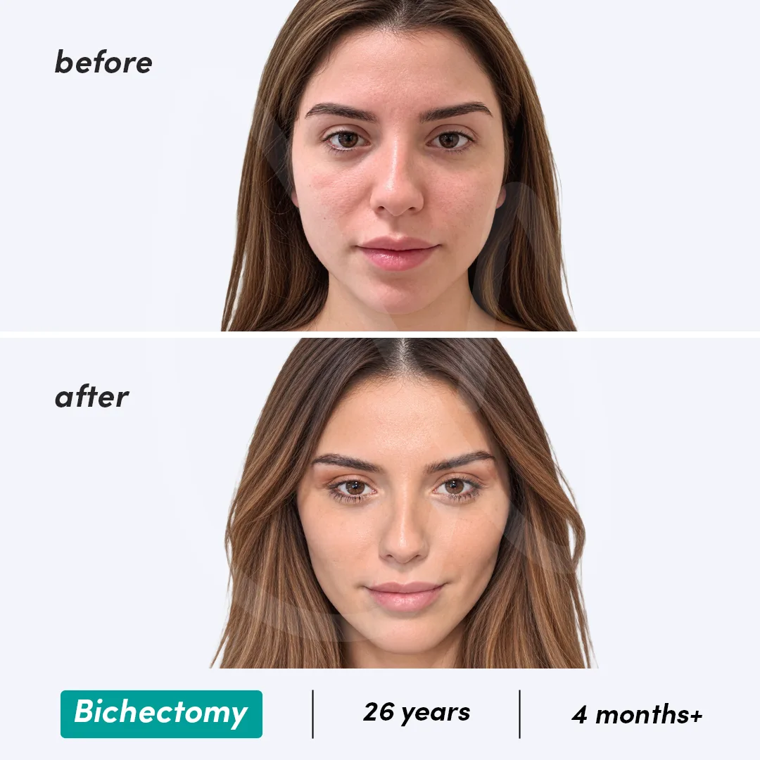 Before-After Combined