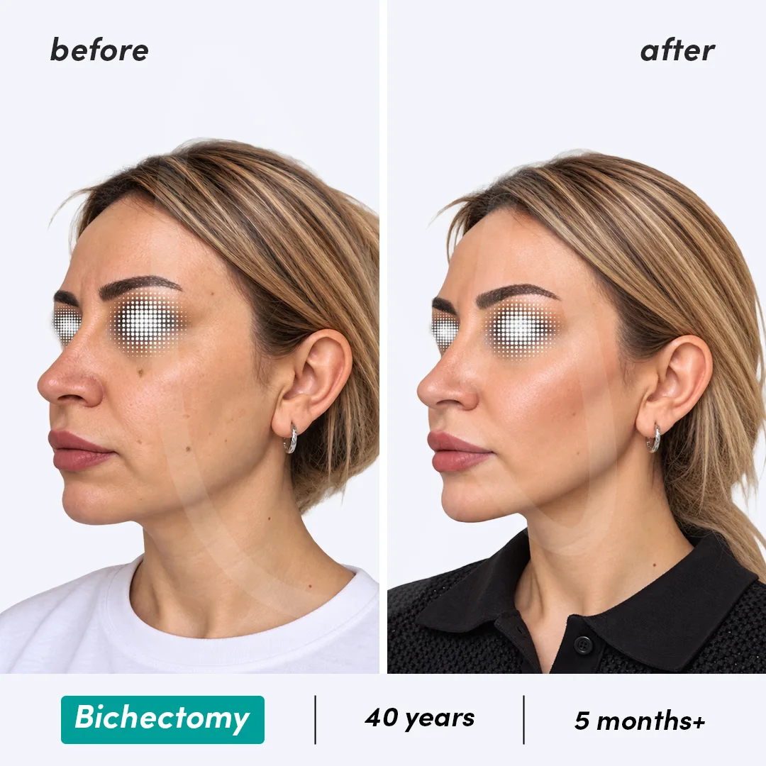 Before-After Combined