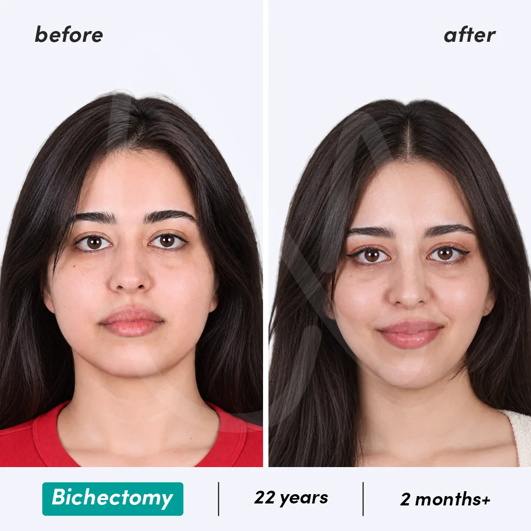 Before-After Combined