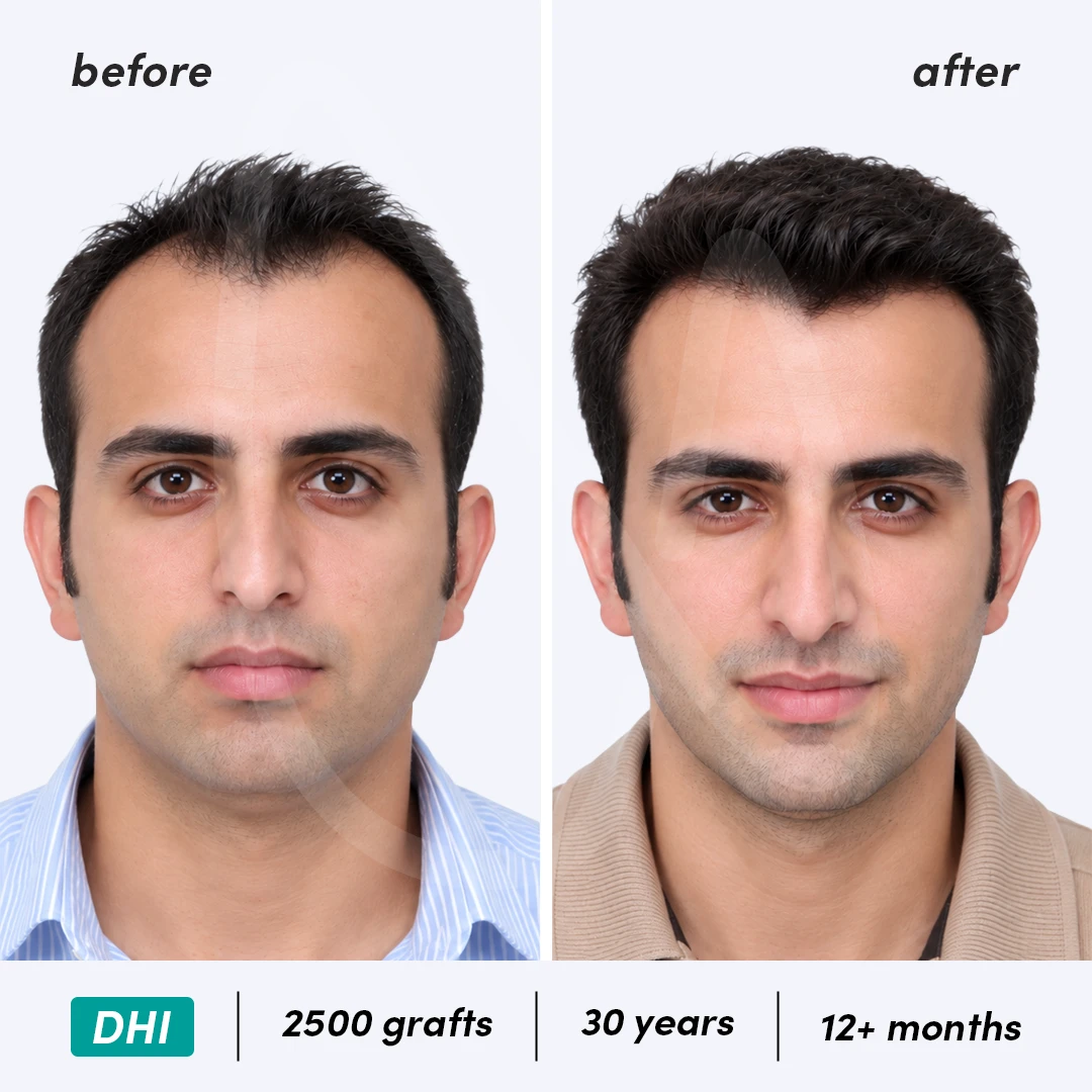 Before-After Combined