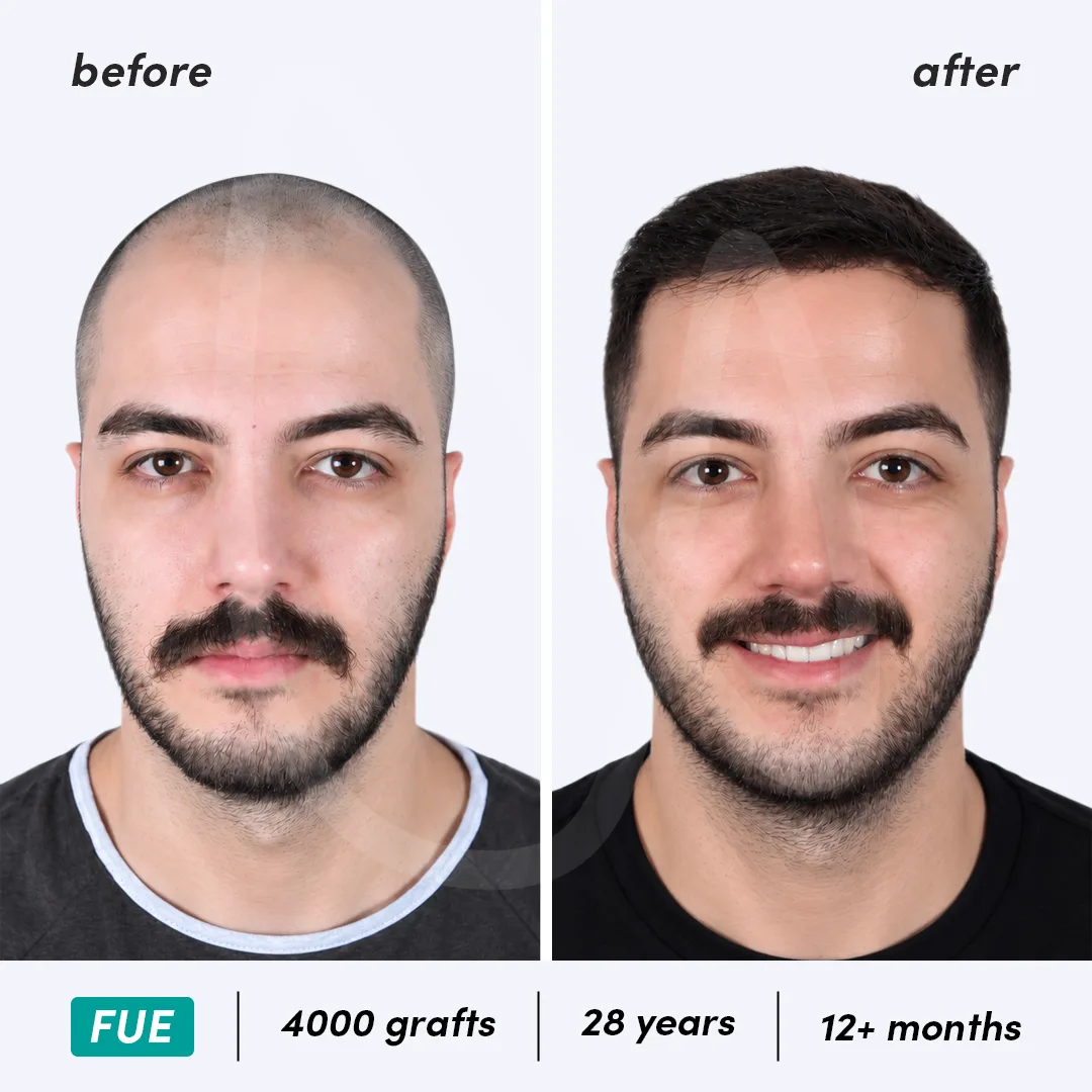 Before-After Combined