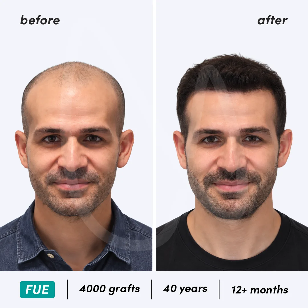 Before-After Combined