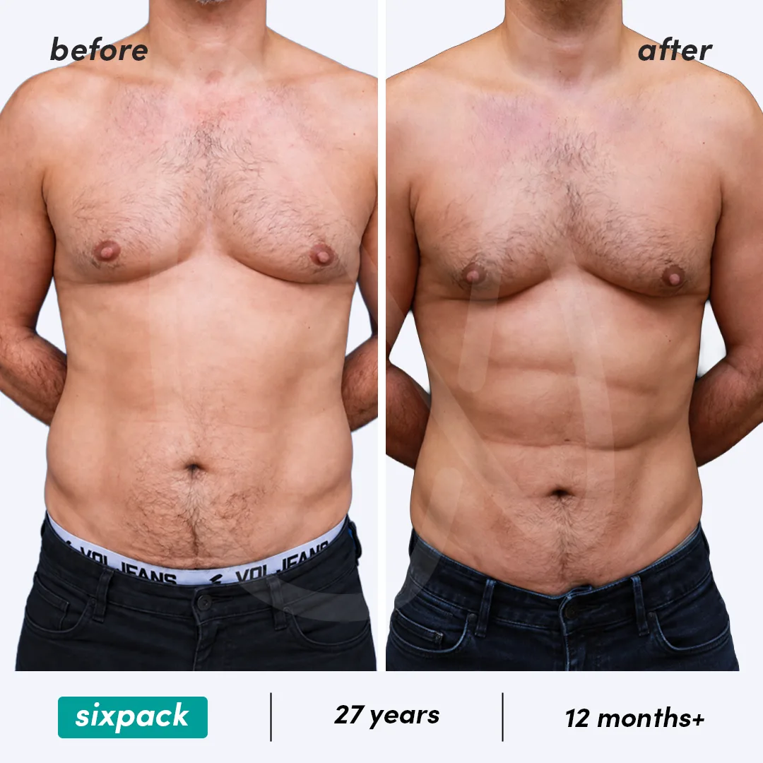 Before-After Combined