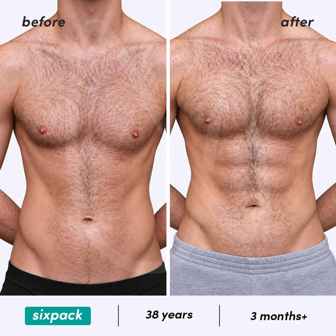 Before-After Combined